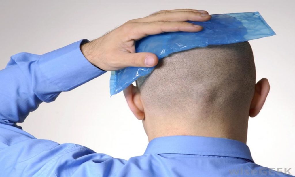 6 Cara Meredakan Sakit Kepala dengan Alami dan Tanpa Efek Samping 