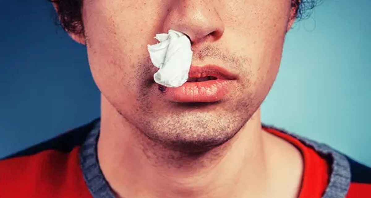 Cara Mengatasi Hidung Tersumbat yang Terjadi Saat Pilek